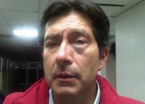Cesar Montufar fue agredido por APes César Montúfar fue golpeado tras sabatina