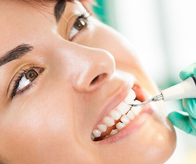 ¿Por qué es importante una profilaxis dental?