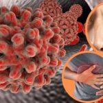 hepatitis-en-ecuador