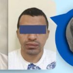 Implantes médicos 3D a la medida en Ecuador