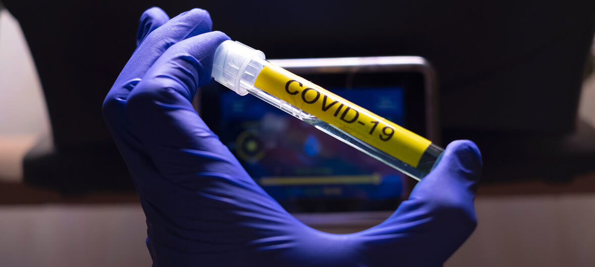vacuna-coronavirus